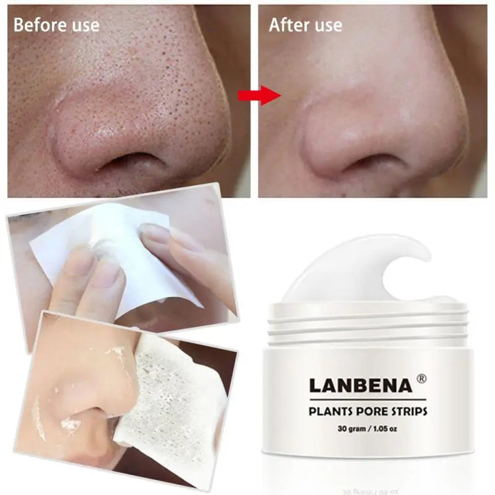 LANBENA Blackhead Removal Cream Acne Peel Off Mask Clay Mask Skin Care - OZAXU