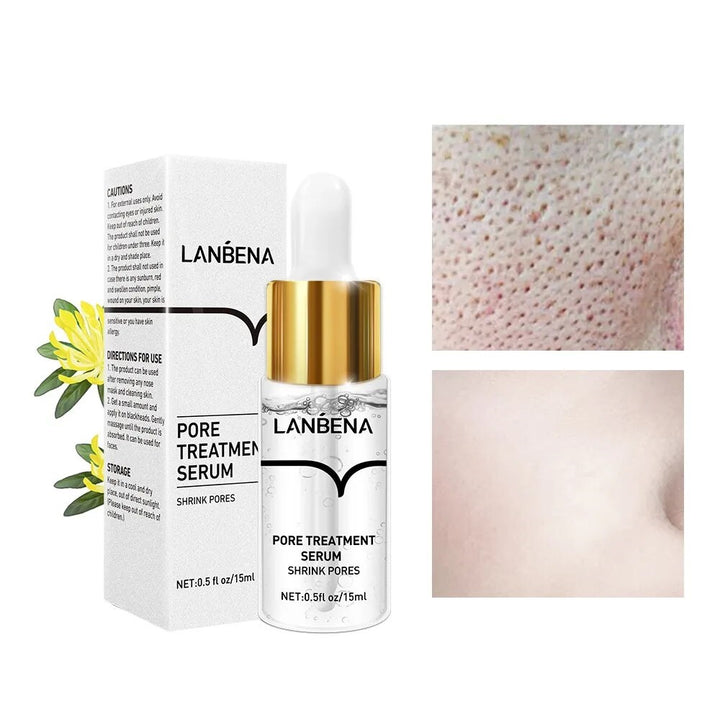 LANBENA to shrink pores treat acne and remove blackheads from the nose - OZAXU